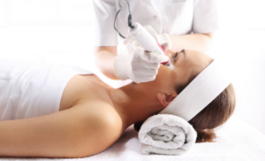 microneedling daddy deals durban