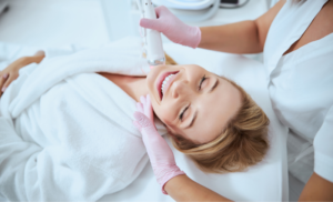 microneedling specials cape town