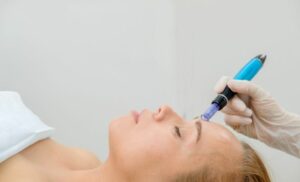 La Glace Beauty Clinic Tygervalley Tyger Valley spa microneedling session cape town