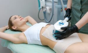 A fat freezing session from La Glace Empire