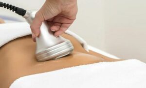 suitable slimming package pretoria spa radio frequency NARL ultrasound cavitation